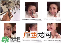 refa去眼袋有效果吗 refa能去眼袋吗
