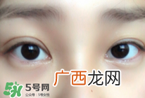 refa去眼袋有效果吗 refa能去眼袋吗