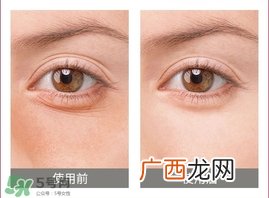 卡琳朵贵妇蛇毒眼膜贴怎么用?使用方法