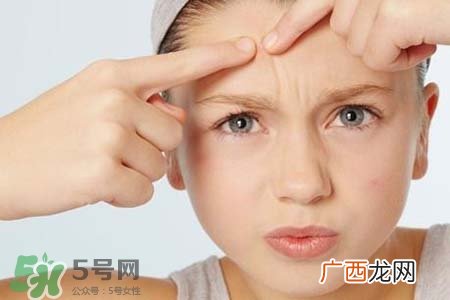 胶原蛋白能祛除痘印吗？胶原蛋白可以去痘坑吗？