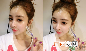 zuzu水光针多少钱一支？zuzu水光针价格