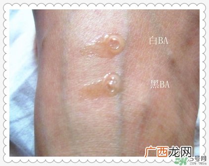 pola黑ba和白ba区别 pola黑ba和白ba不同功效作用