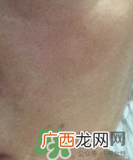 skin1004是什么牌子？skin1004属于什么档次