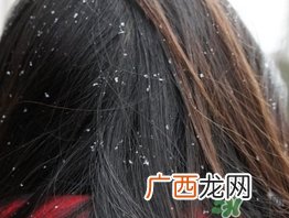 头皮屑多又痒怎么办?头皮屑又多又痒怎么去除?