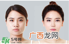 瘦脸绷带是否真的有效?瘦脸绷带有用吗?
