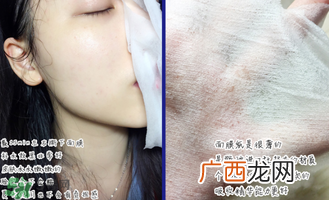 稚优泉面膜怎么用？稚优泉面膜要洗吗？