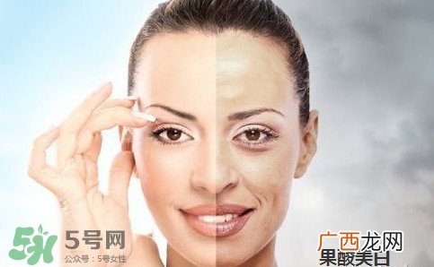 果酸换肤后怎么护理?果酸换肤后多久可以化妆?