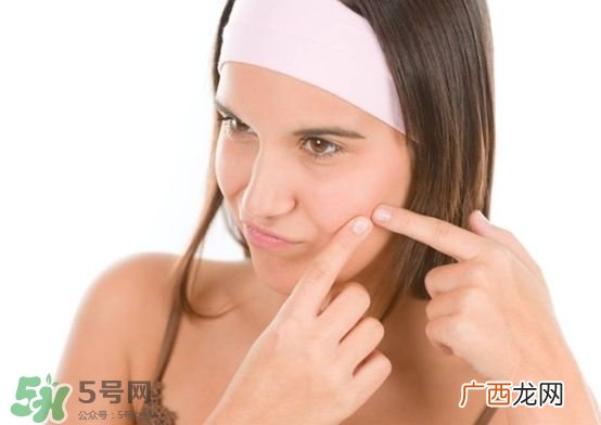 水杨酸可以祛痘印吗 水杨酸可以去闭口吗?
