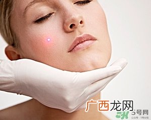 针清痘痘真的能好吗?针清痘痘后几天能好?