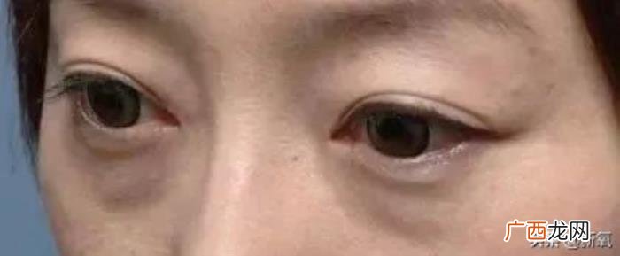 乔欣的眼睛，网友diss乔欣眼睛无神运势不好