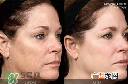 revive护肤品怎么样?revive是什么牌子?