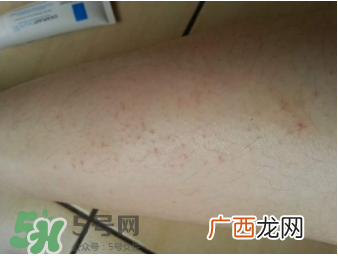 理肤泉b5修复霜怎么样？理肤泉b5可以天天用吗？