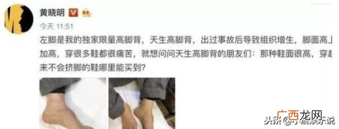 多高王俊凯，当不到180的王俊凯碰上净身高179的黄晓明