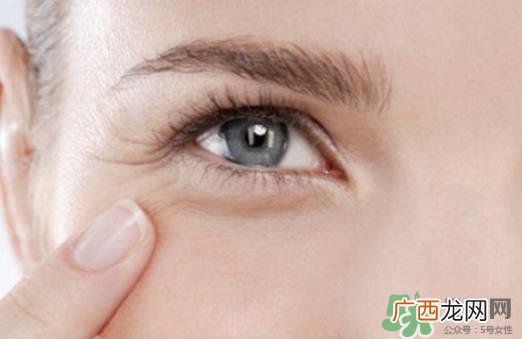 眼霜可以去除鱼尾纹吗?眼霜可以消除鱼尾纹吗?