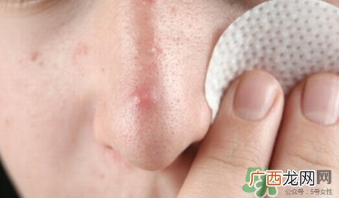鼻子上长痘痘是什么原因?鼻子上长痘痘怎么办?