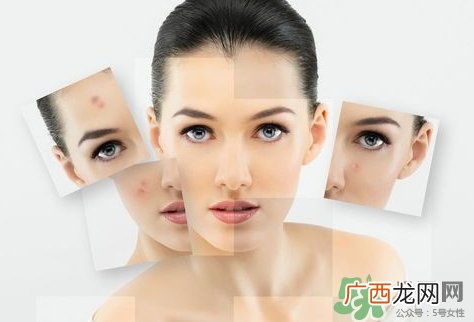 鼻子上长痘痘用什么药膏?鼻子上长痘痘涂什么药?