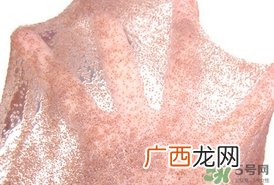 海藻面膜适合什么皮肤?海藻面膜适合什么肤质?