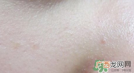 春雨碳酸泡泡面膜真假 春雨泡泡面膜真假鉴别
