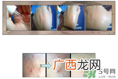 达尔肤dr.wu杏仁酸真假辨别方法