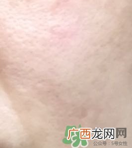 雪露紫b12面霜多少钱?雪露紫b12面霜专柜价格
