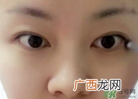 兰蔻大眼精华多少钱几毫升?兰蔻大眼精华专柜价格