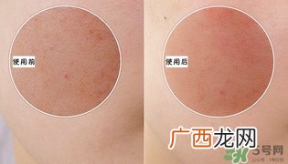 holika懒蛋蛋去角质多少钱？holika鸡蛋去角质啫喱价格
