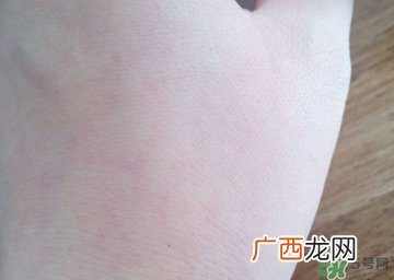 兰蔻小黑瓶适合孕妇吗?孕妇能用兰蔻小黑瓶吗?
