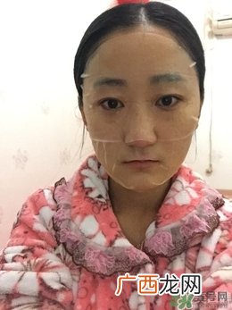 高丽雅娜肉毒杆菌使用方法 高丽雅娜肉毒杆菌怎么打开