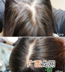 hairmax激光生发梳怎么用?hairmax激光生发梳使用心得