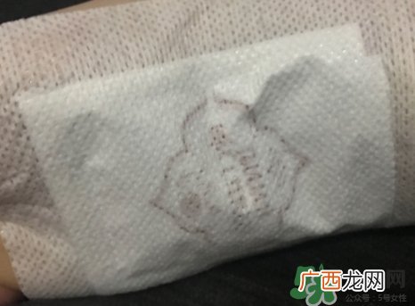足贴真的可以去湿气吗？足贴去湿气是真的吗？