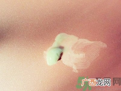 白兔祛痘膏怎么用？白兔牌暗疮膏怎么用？