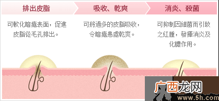 日本白兔牌暗疮膏价格 白兔祛痘膏多少钱？