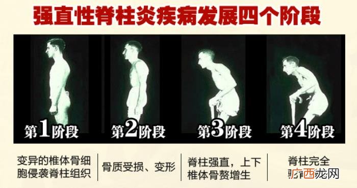 张嘉译走路，男神张嘉译走路甩臂摇尾、慵懒模样