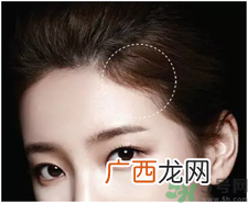 发际线可以自己刮吗?发际线可以自己修吗?