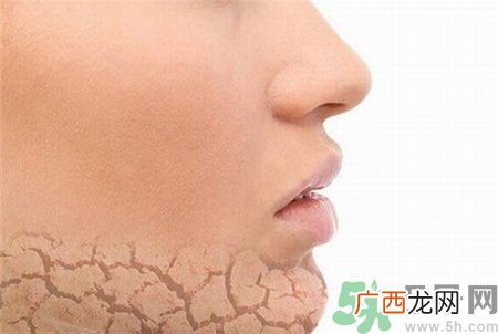 皮肤缺水有哪些症状?皮肤缺水会导致哪些问题?