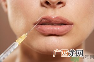 打胶原蛋白好还是玻尿酸好,玻尿酸和胶原蛋白的区别