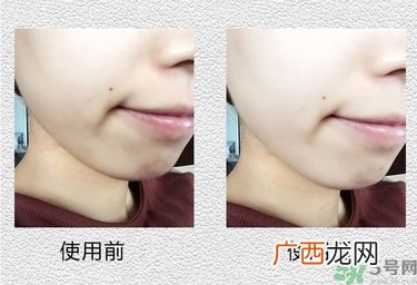 jayjun维他命药丸面膜真假辨别 jayjun药丸面膜真假辨别图