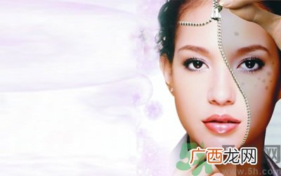 色斑分为哪几种？有色斑该多吃什么好？