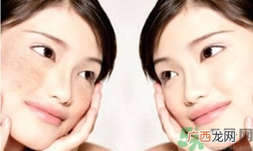 色斑分为哪几种？有色斑该多吃什么好？