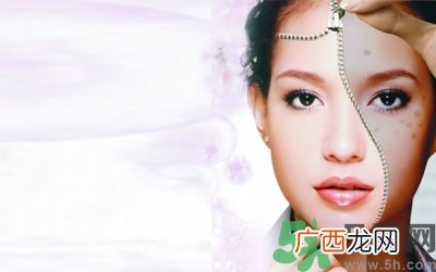色斑会自己消失吗？色斑遗传吗？