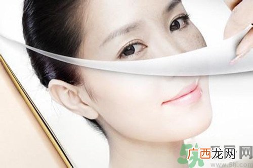 晒斑可以自己消退吗？晒斑可以用激光去除吗？