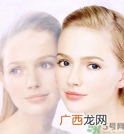 晒斑可以自己消退吗？晒斑可以用激光去除吗？