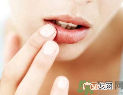 孕妇嘴唇干裂脱皮怎么回事？孕妇嘴唇干裂脱皮是缺什么