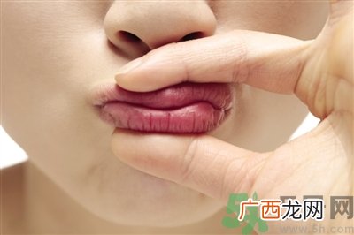 孕妇嘴唇干裂脱皮怎么回事？孕妇嘴唇干裂脱皮是缺什么