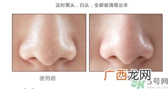 yu.r巧克力棒鼻贴怎么样？yu.r巧克力鼻贴好用吗？