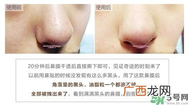 yu.r巧克力棒鼻贴真假 韩国巧克力棒鼻贴真假辨别图