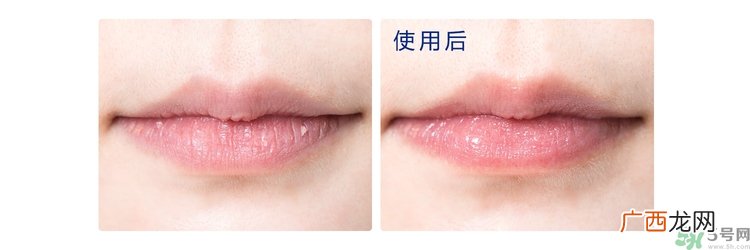 碧唇小蓝罐唇膏孕妇可以用吗？blistex碧唇小蓝罐专柜价格