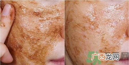 skin food思亲肤适合什么年龄？思亲肤适合多大年龄？