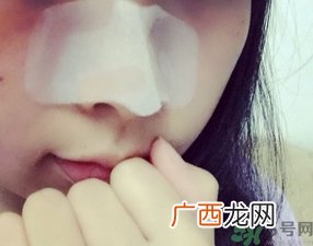 丽得姿鼻贴三部曲多少钱?丽得姿鼻贴三部曲专柜价格
