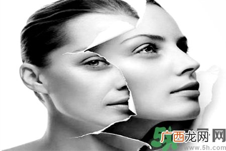 点痣后有红印怎么办？点完痣后留下红印和坑怎么修复？